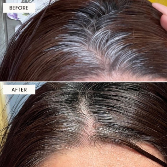 💥SOLD💥NEW Arey Grey System with TWO bottles of supplements & TWO serums - Picture 2 of 7